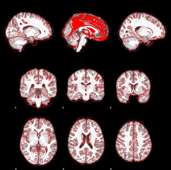 Example image in the reorganized 3x3 format